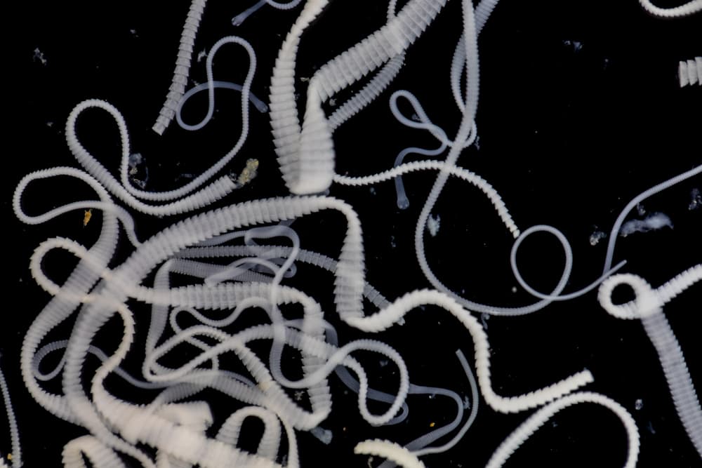 tapeworms under a microscope