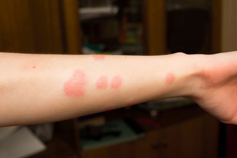 Can Humans Get Fleas From Dogs? Great Pet Care