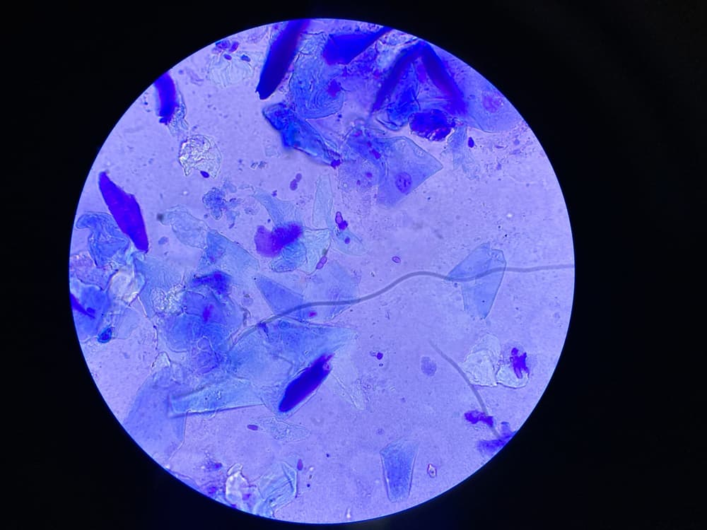 Microscopic view of Malassezia pachydermatis cells taken from dog with ear infection